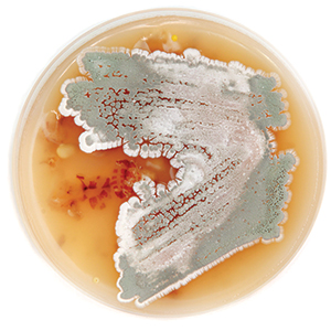 "streptomyces bacteria in petri dish"