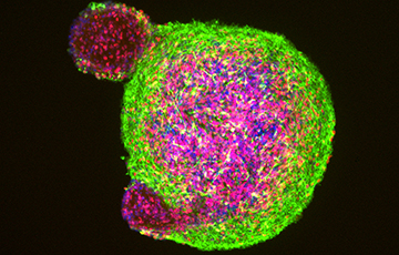 brain organoid