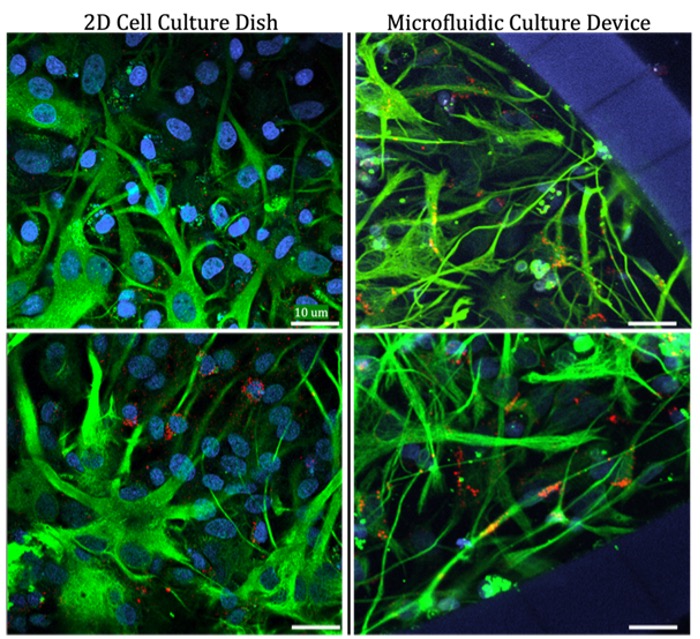 astrocyte morphology examples