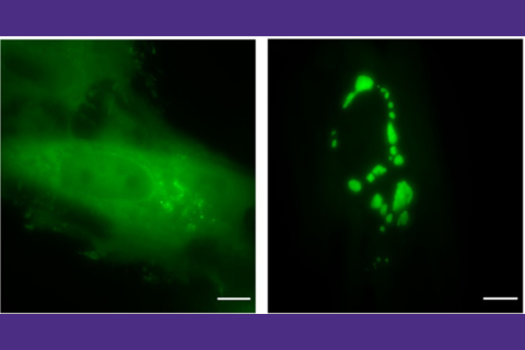 image of hydrogels forming both inside and outside of cells