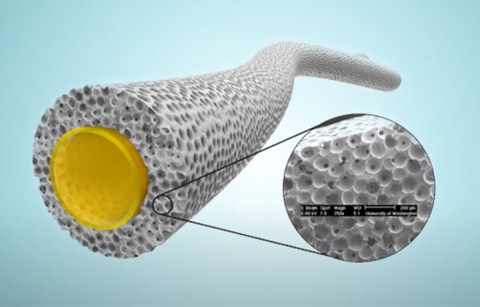illustration of arteriovenous graft
